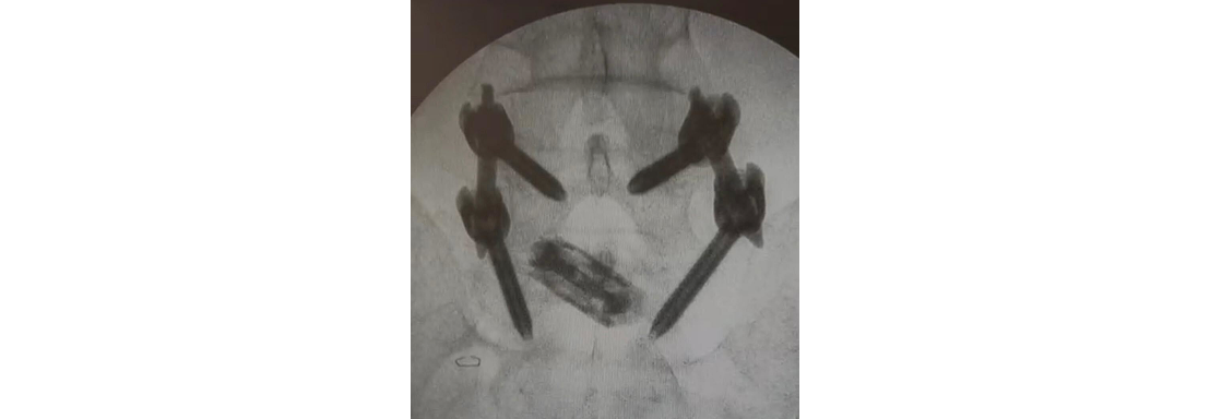 imagewithfallback (1)